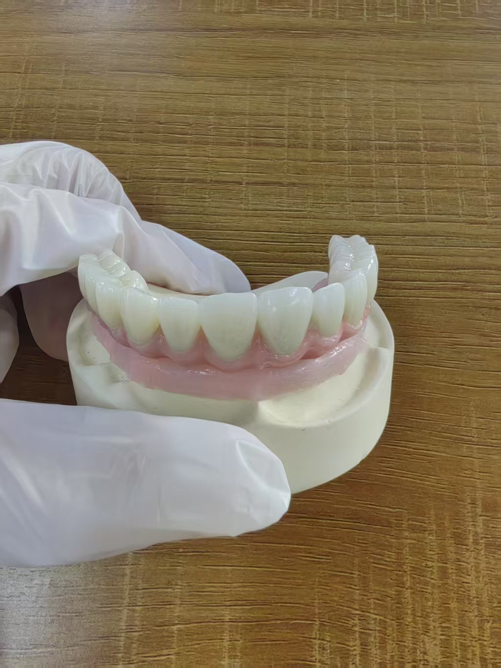 Malo Bridge Pure Titanium Metal Frame Full Arch Restoration Dental Lab In China