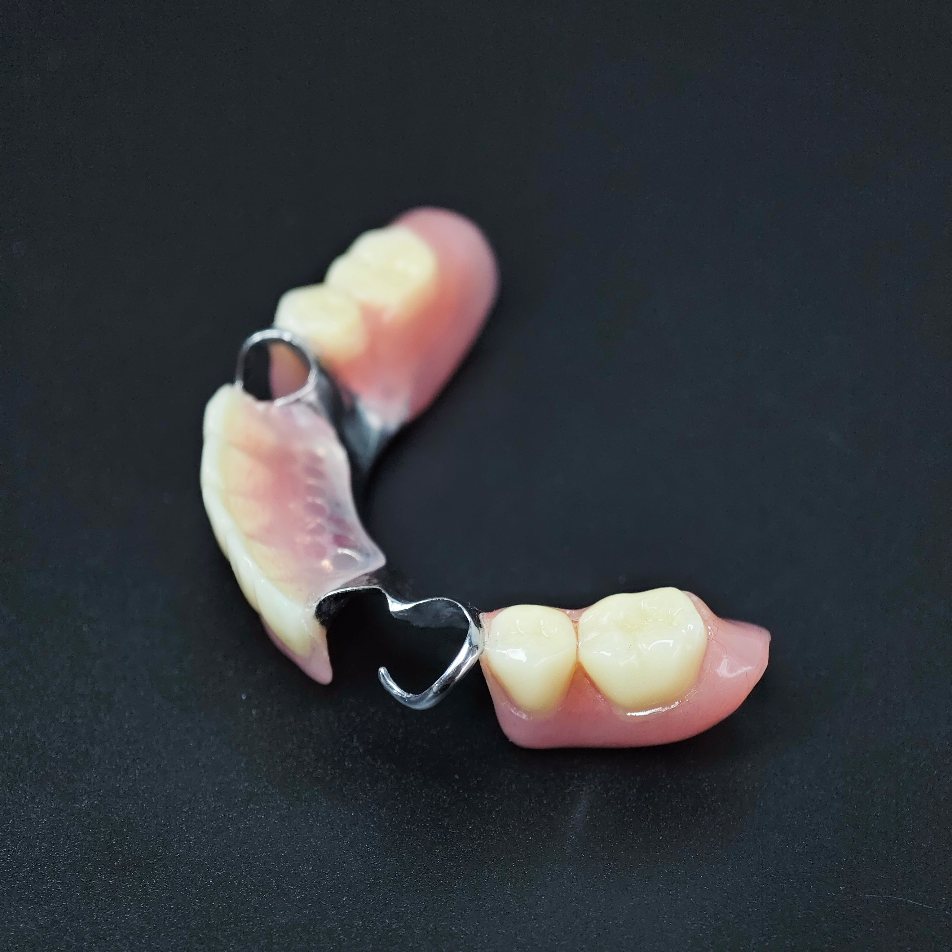 Cobalt Chrome Framework Denture Metal Framework With Acrylic Denture