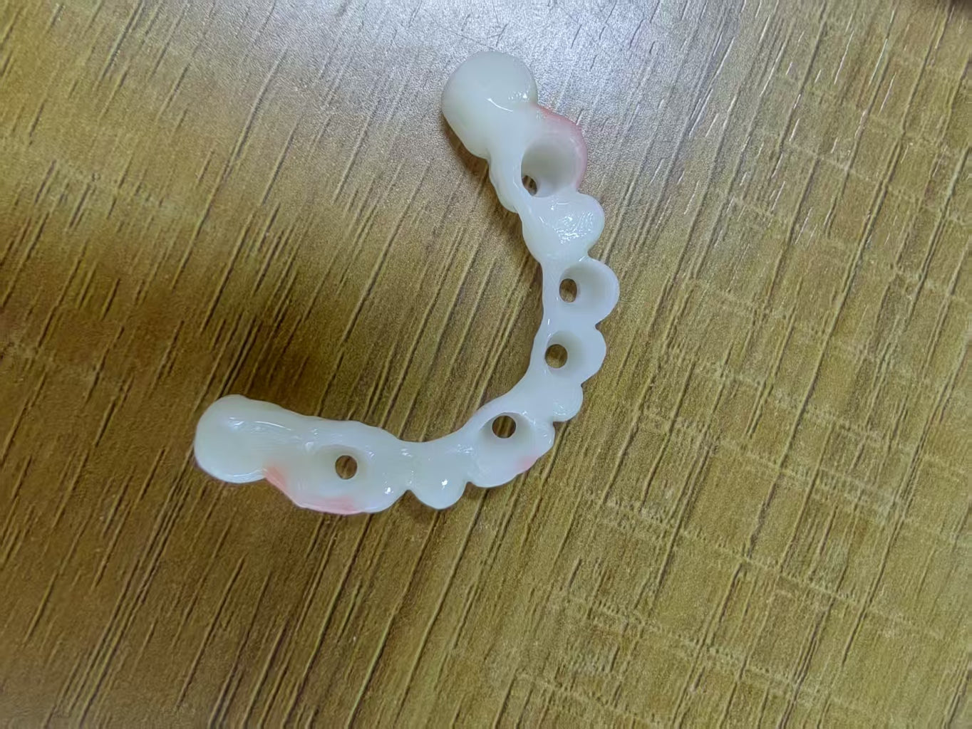 PMMA Bridge After We Received The Surgical Implant Plan Leave Holes Immediate Temporary Teeth