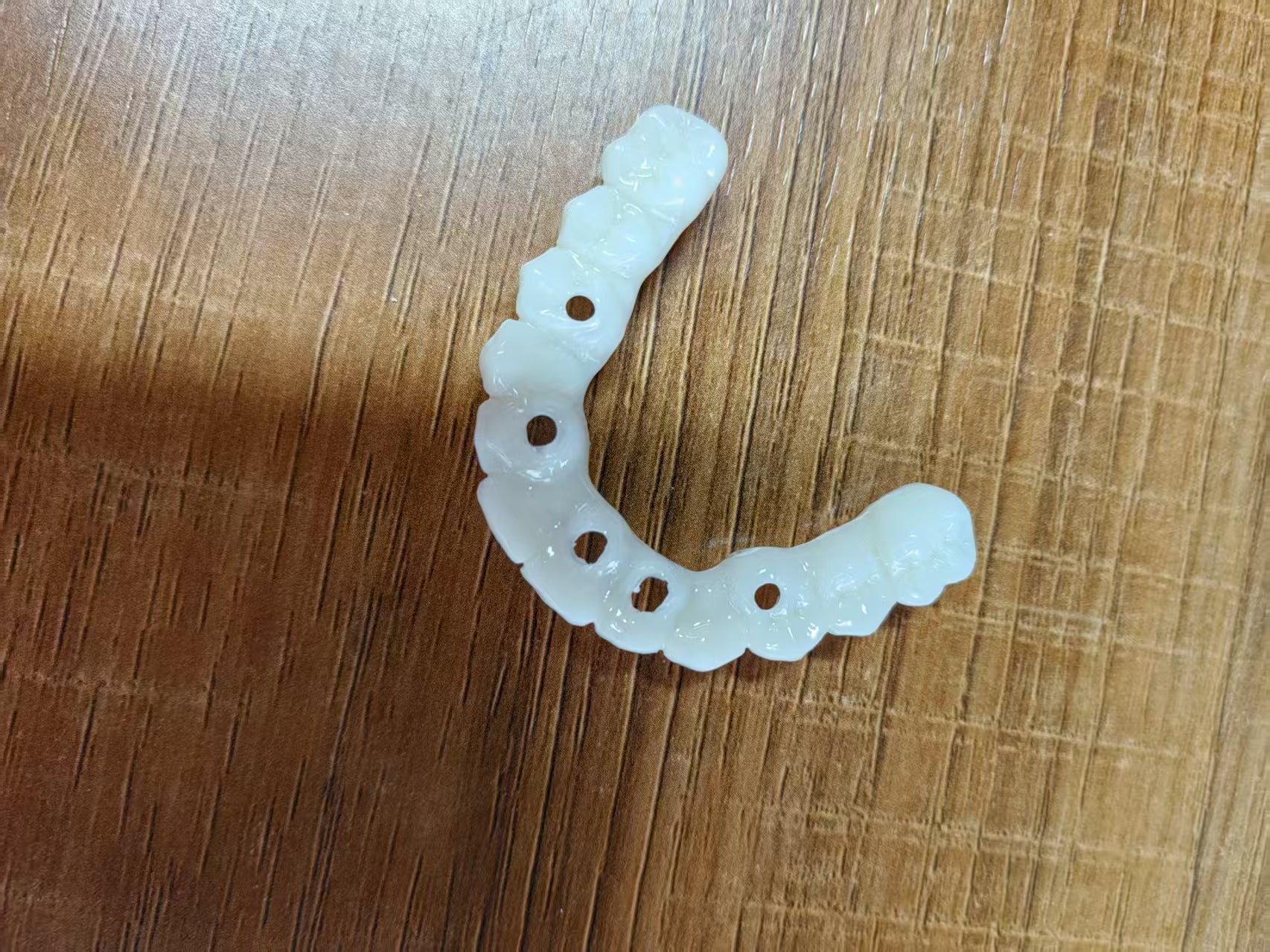 PMMA Bridge After We Received The Surgical Implant Plan Leave Holes Immediate Temporary Teeth