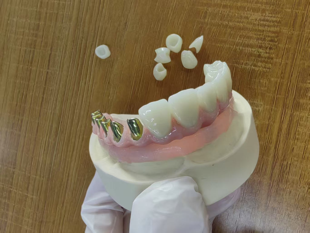 Malo Bridge Pure Titanium Metal Frame Full Arch Restoration Dental Lab In China