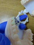PFM Single Crowns With Metal Surface Dental Lab Cases