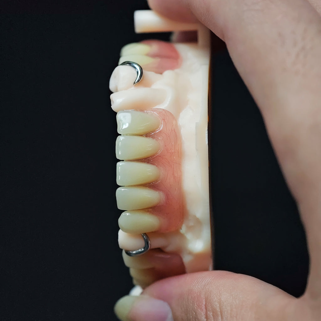 Cobalt Chrome Framework Denture Metal Framework With Acrylic Denture
