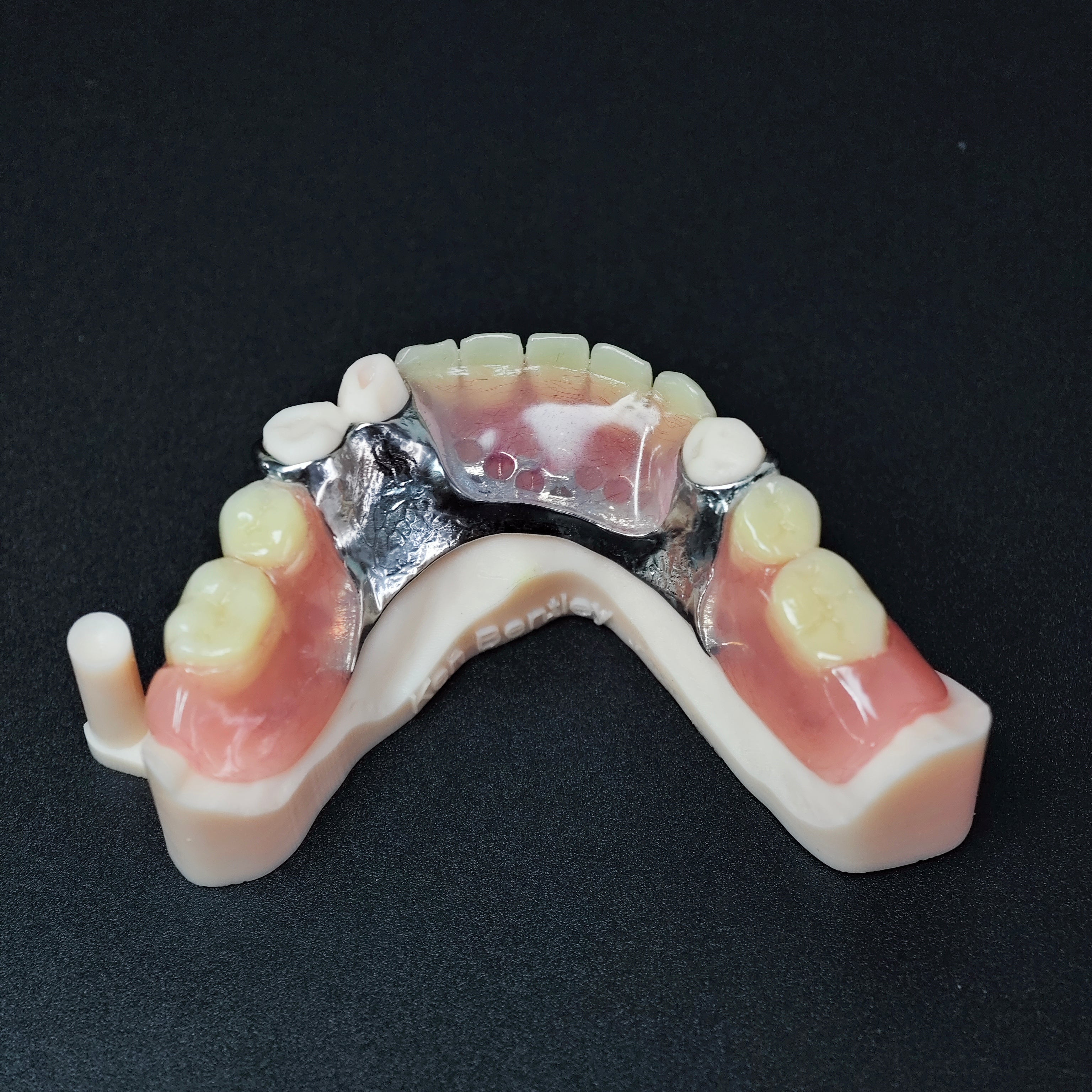 Cobalt Chrome Framework Denture Metal Framework With Acrylic Denture