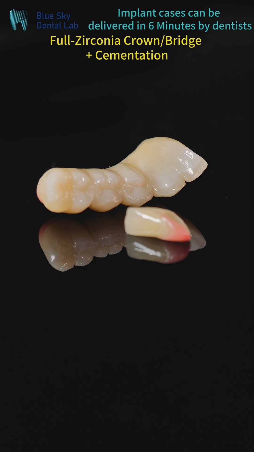 High - Strength Zirconia Crown And Bridge