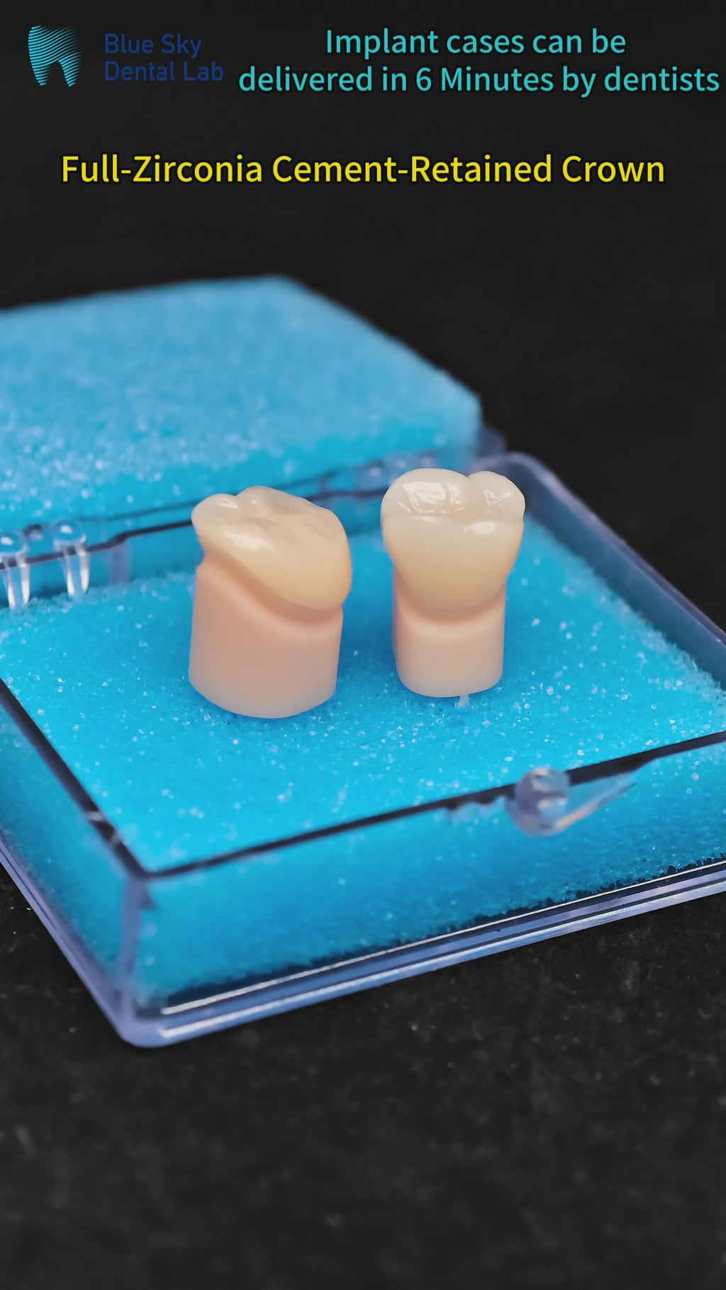 High - Strength Zirconia Dental Crowns