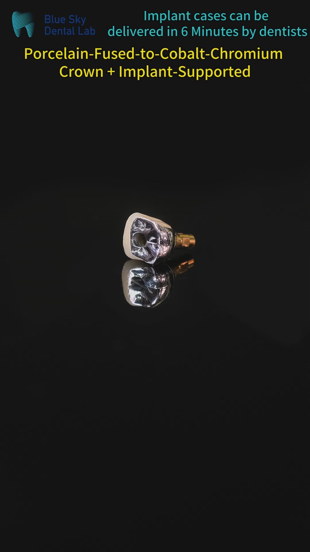 Implant-Supported PFM Single Crown With Metal