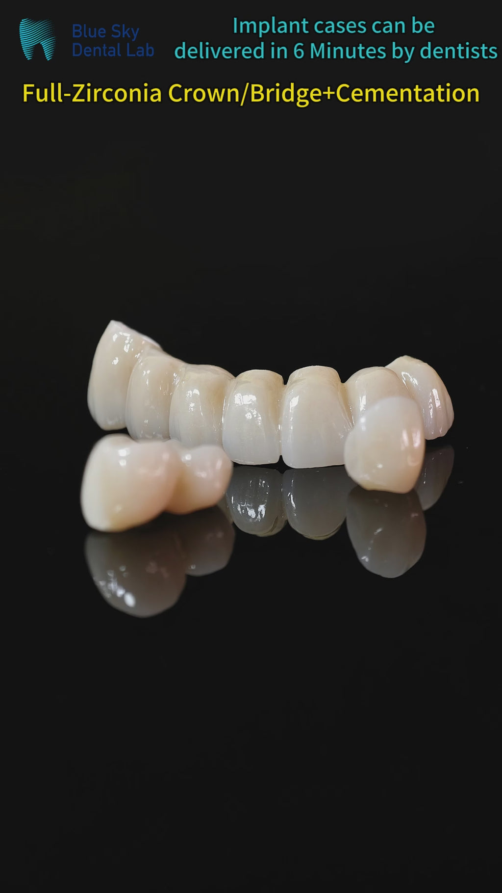 High - Strength Zirconia Crowns And Bridge