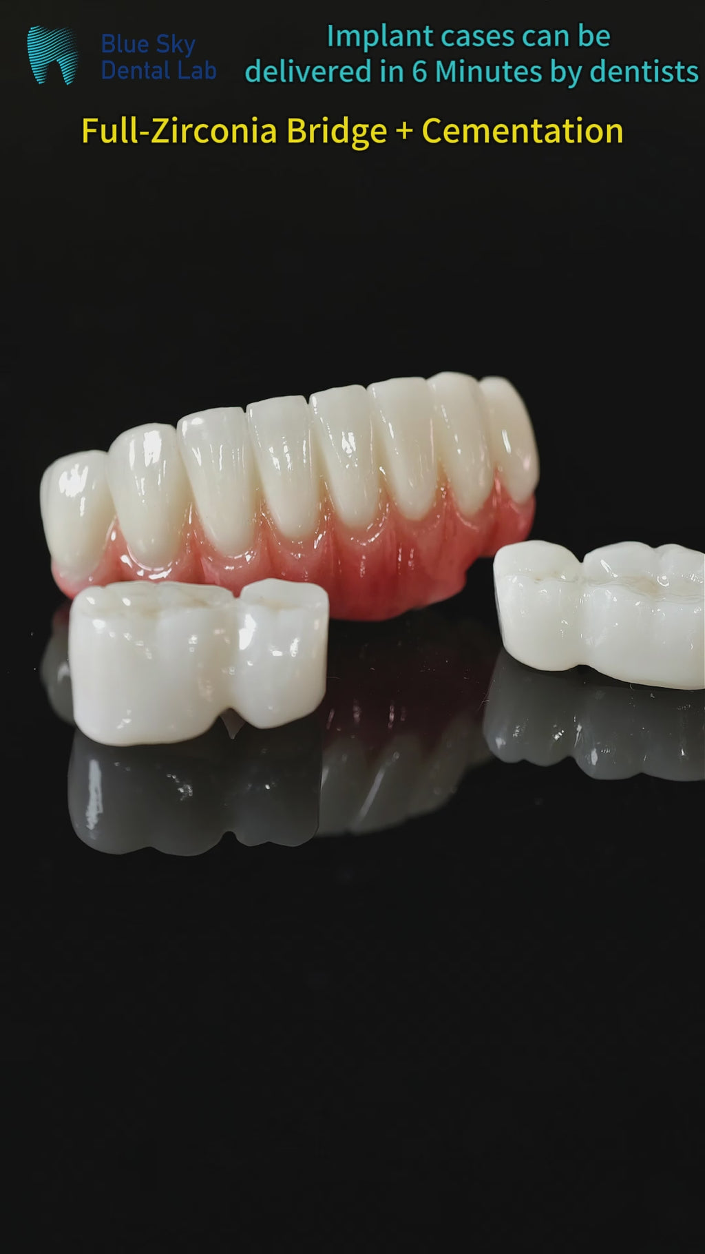 High - Strength Zirconia Crowns And Bridge