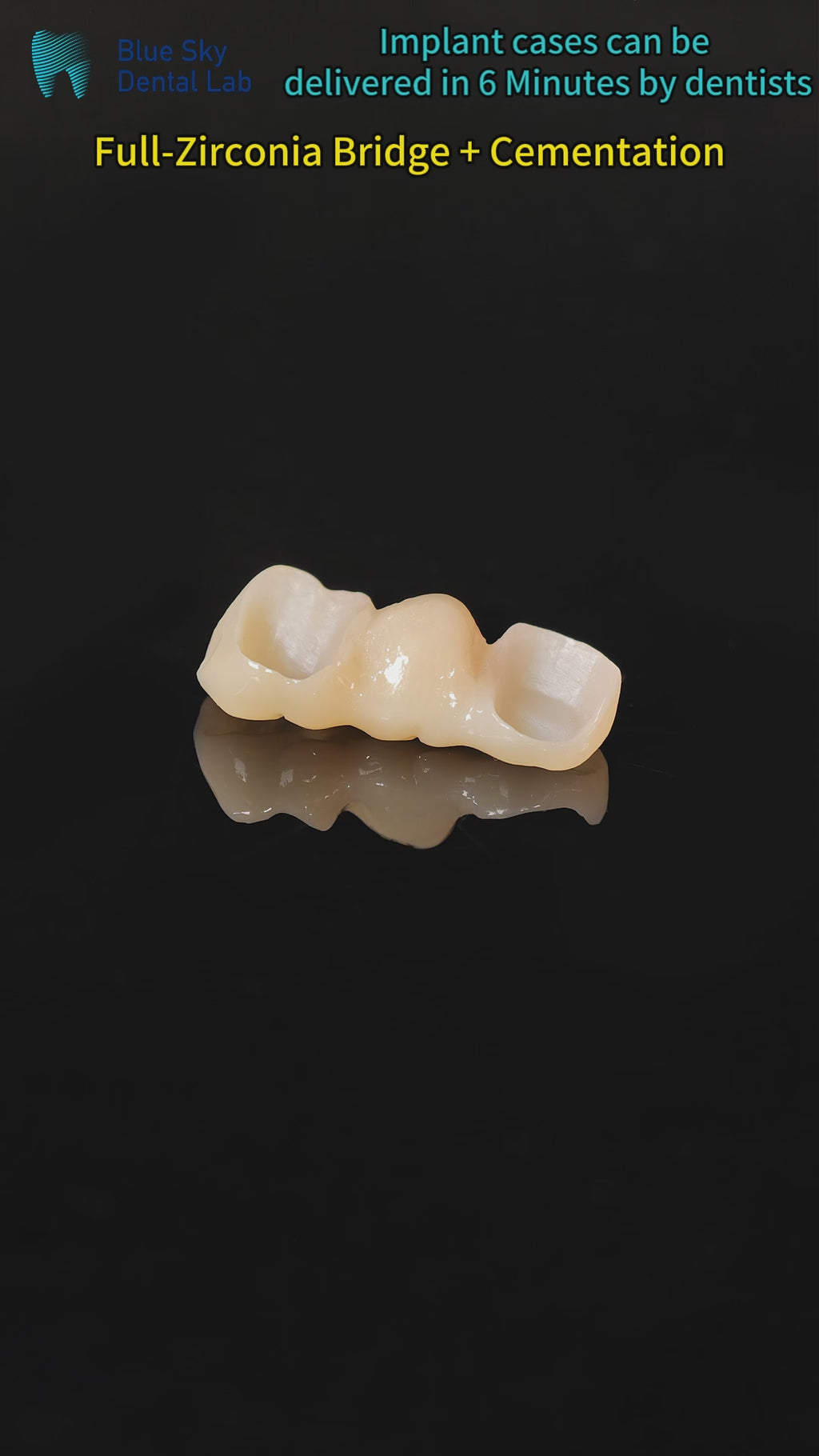 High - Strength Zirconia Bridge
