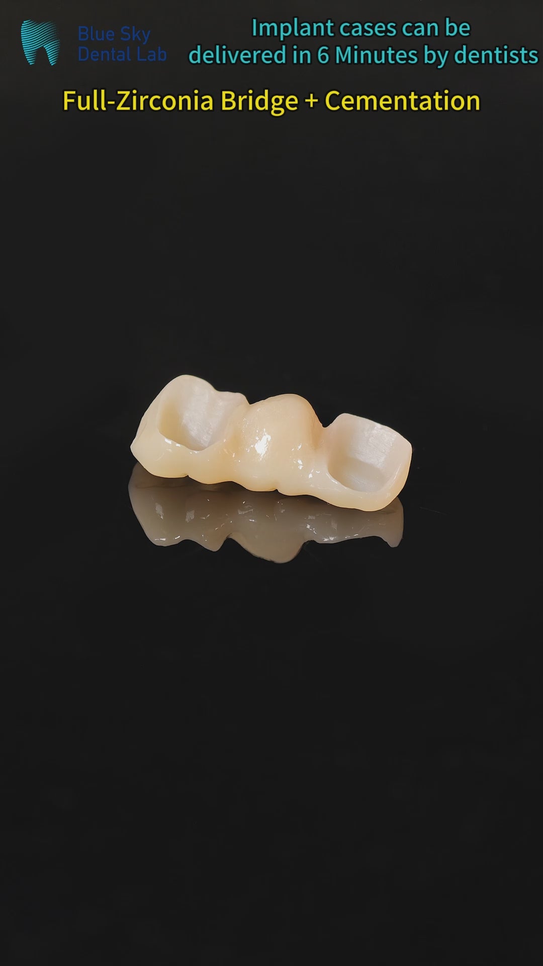 High - Strength Zirconia Bridge