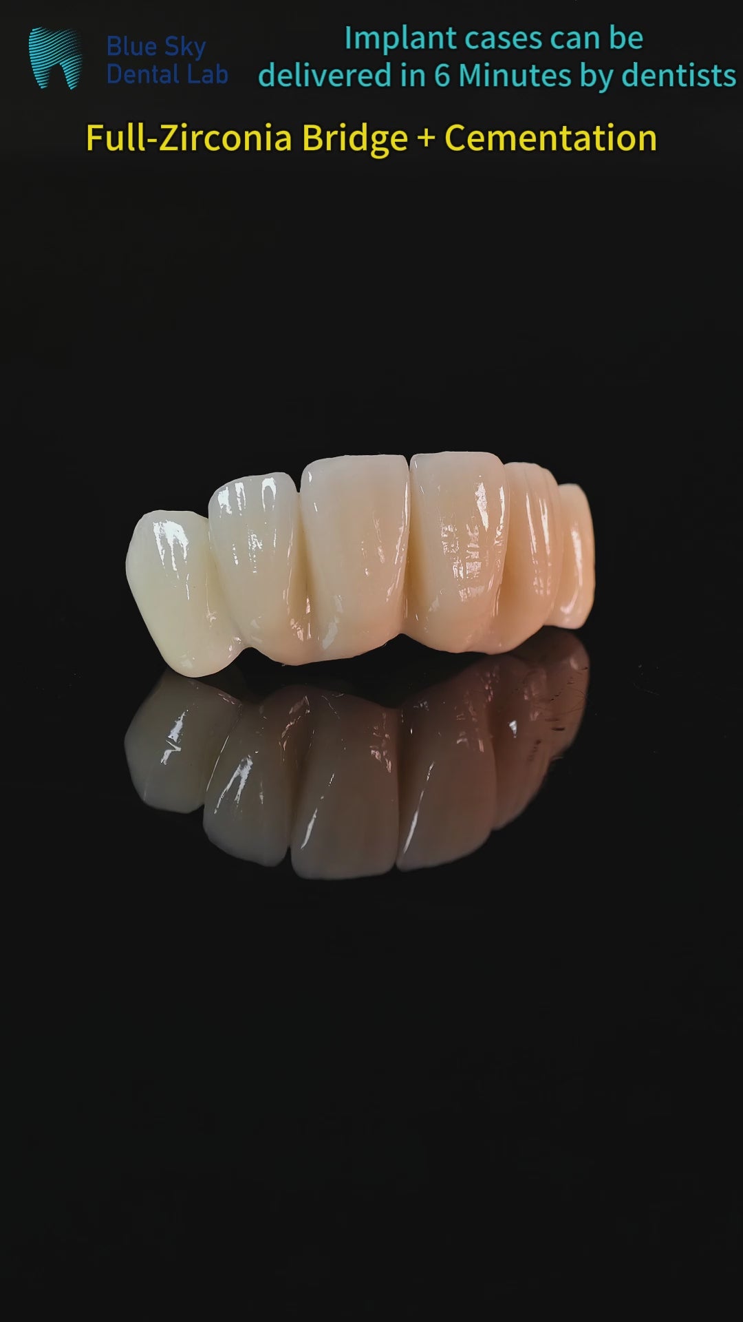 High - Strength Zirconia Bridge