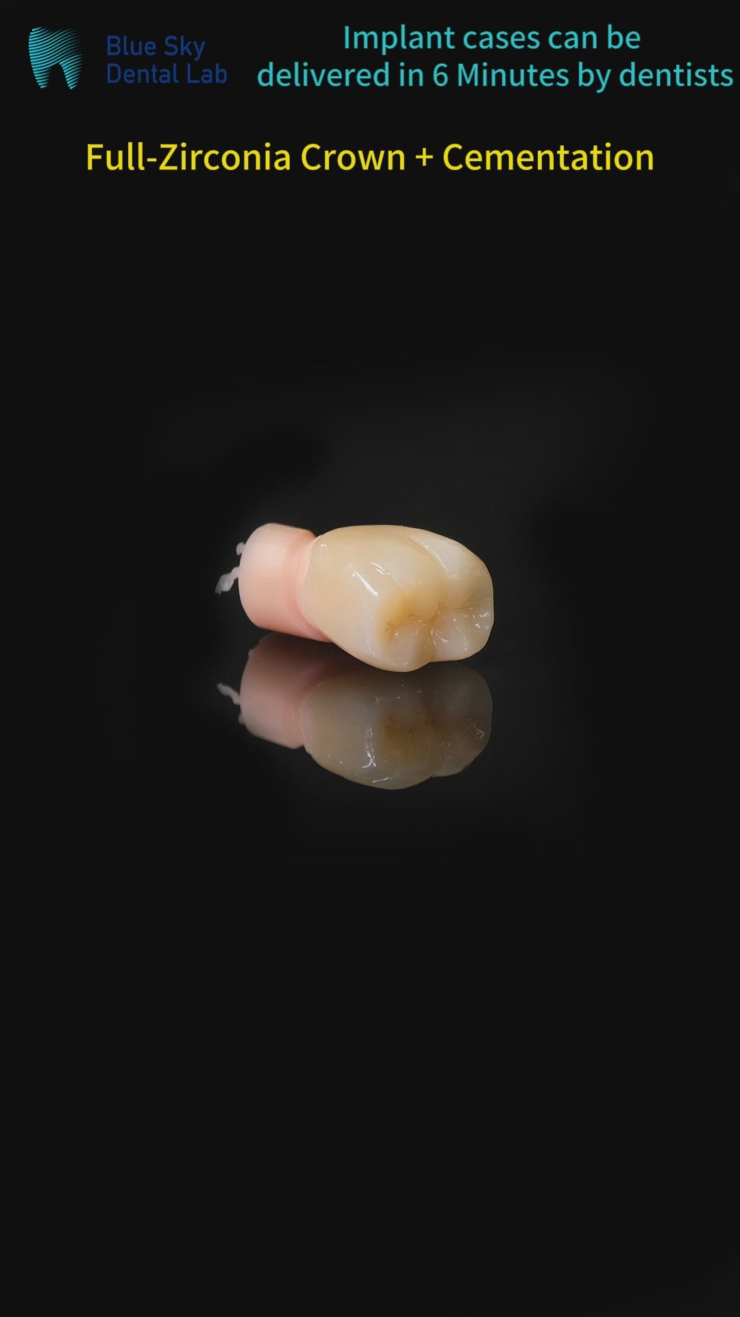 High - Strength Zirconia Dental Crown
