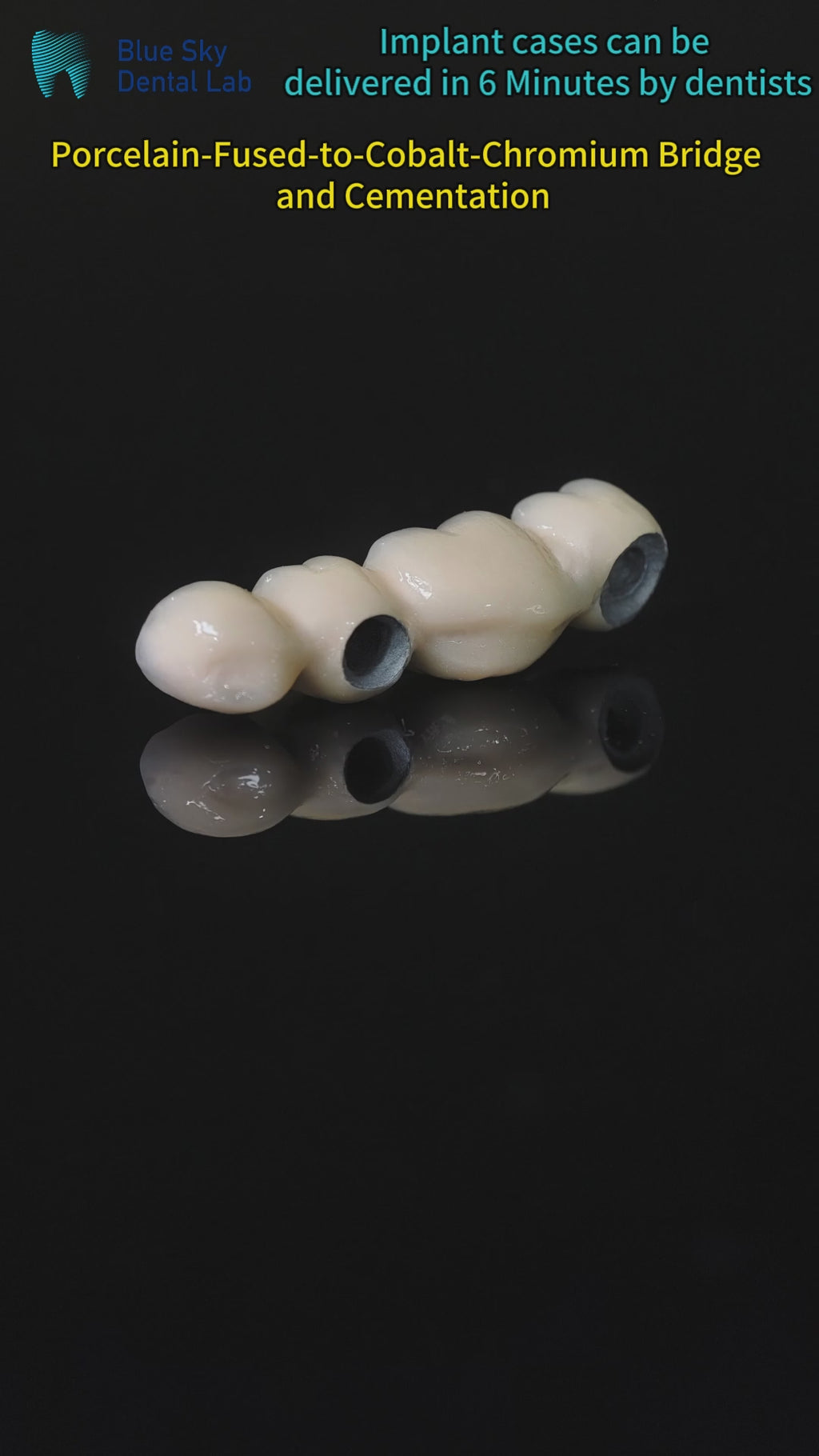 Co - Cr PFM Dental Bridge