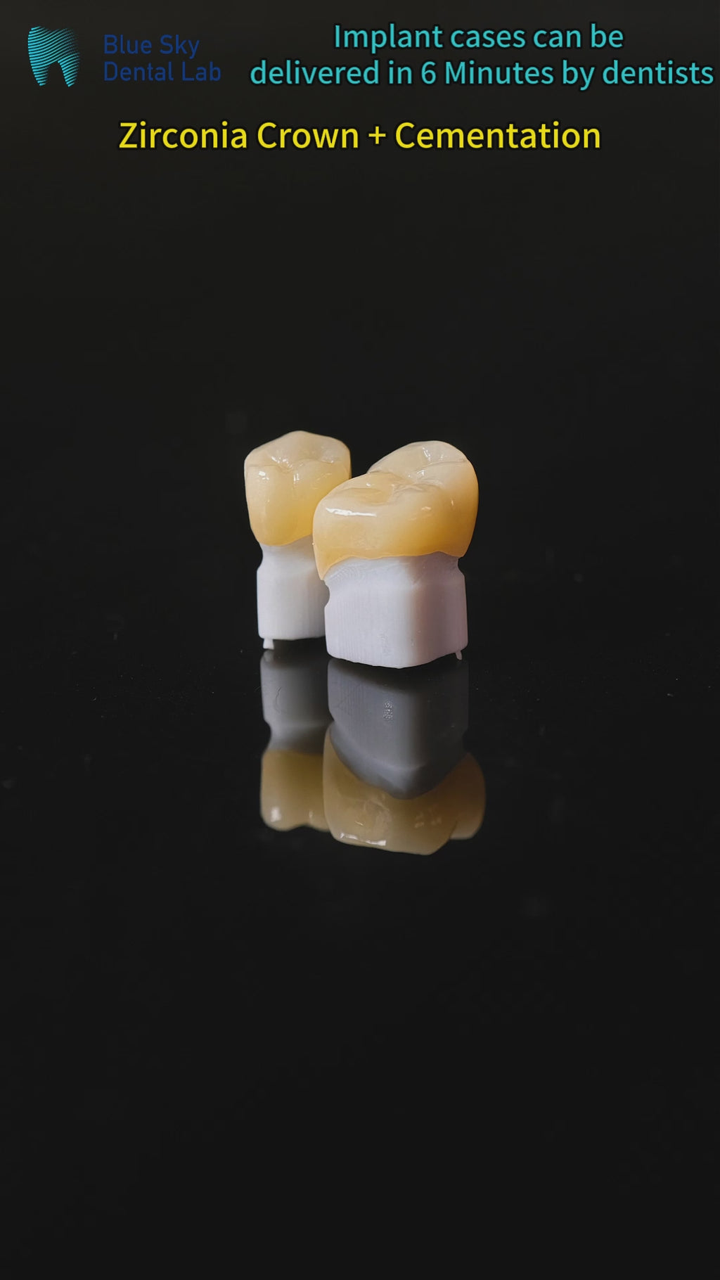High - Strength Zirconia Dental Crowns