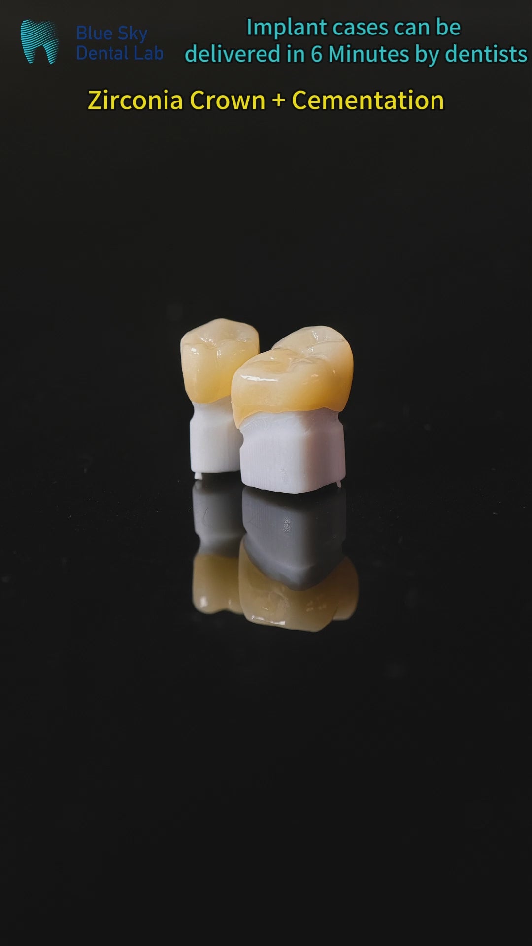 High - Strength Zirconia Dental Crowns