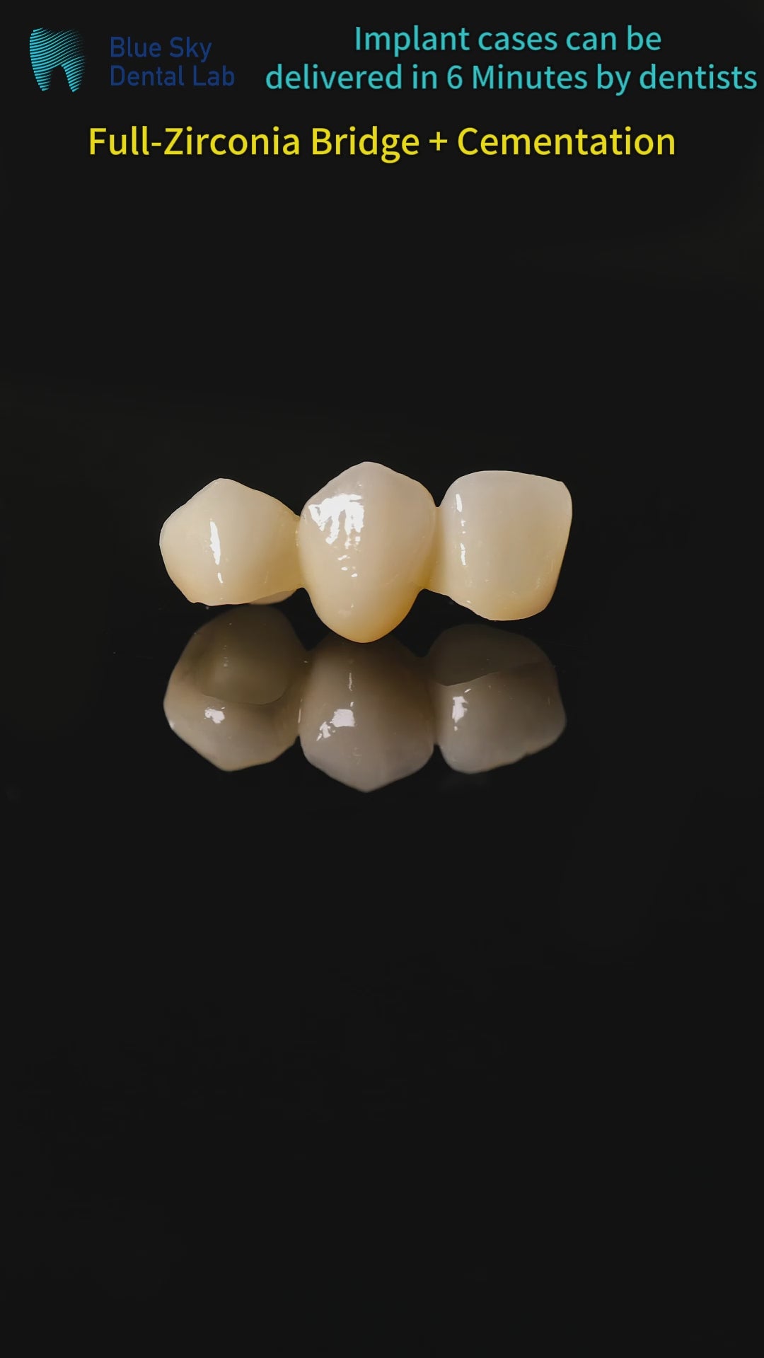 High - Strength Zirconia Bridge