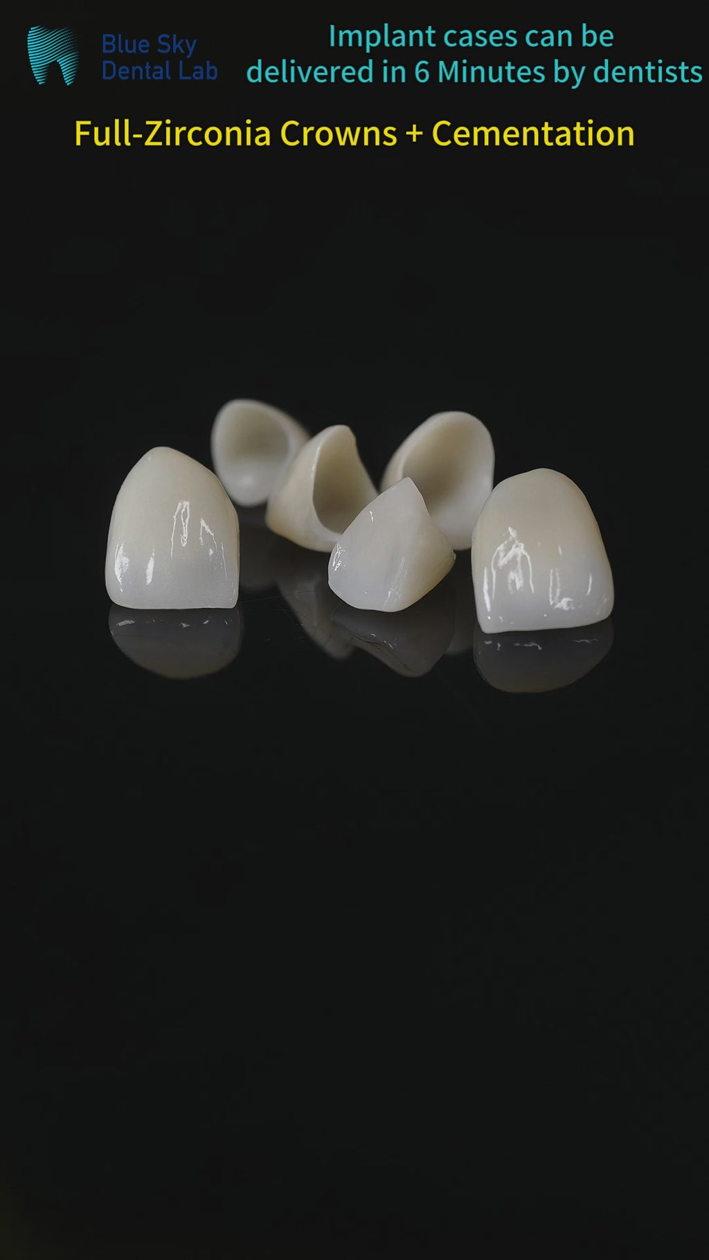 High - Strength Zirconia Crowns