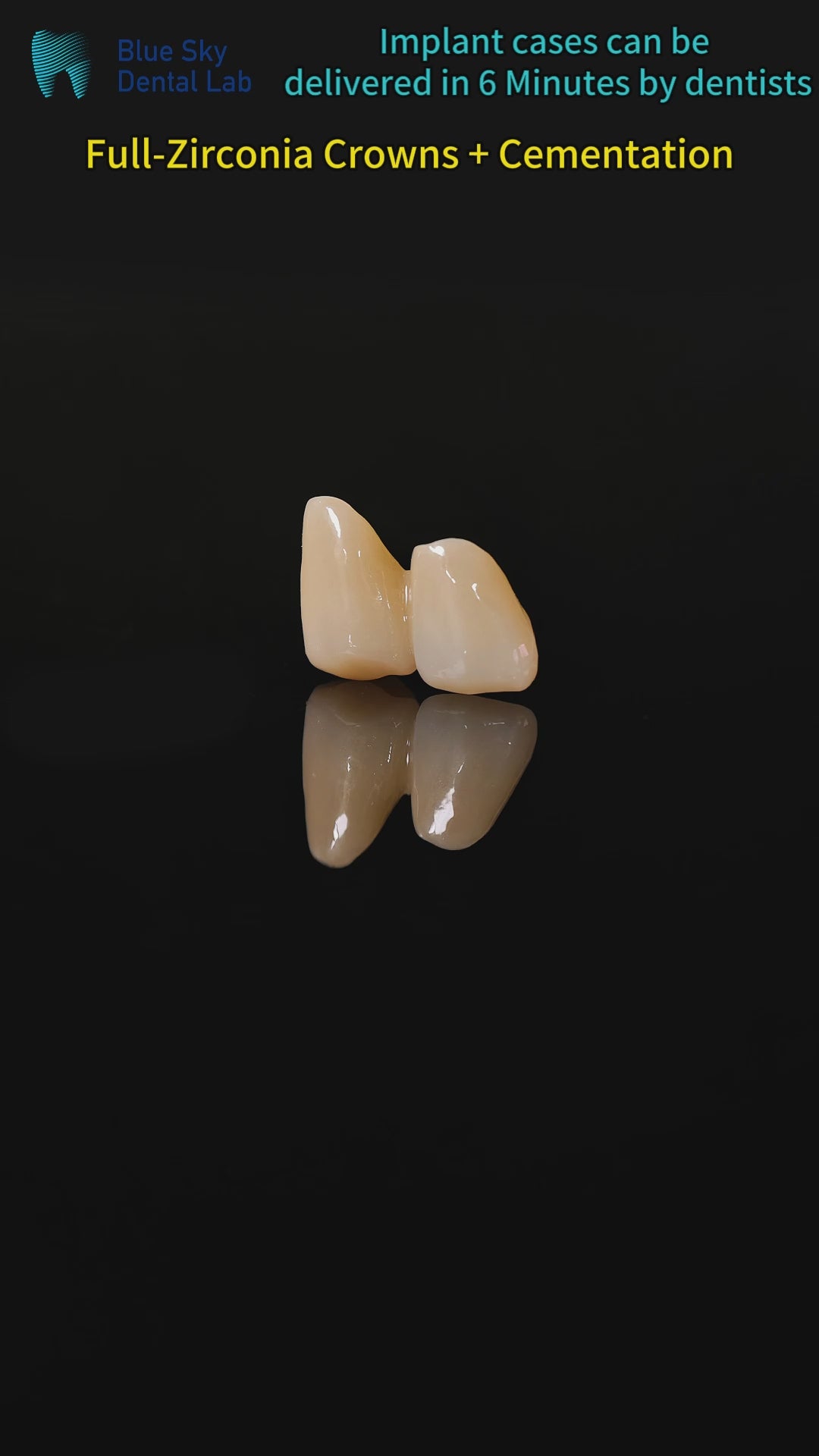High - Strength Zirconia Bridge