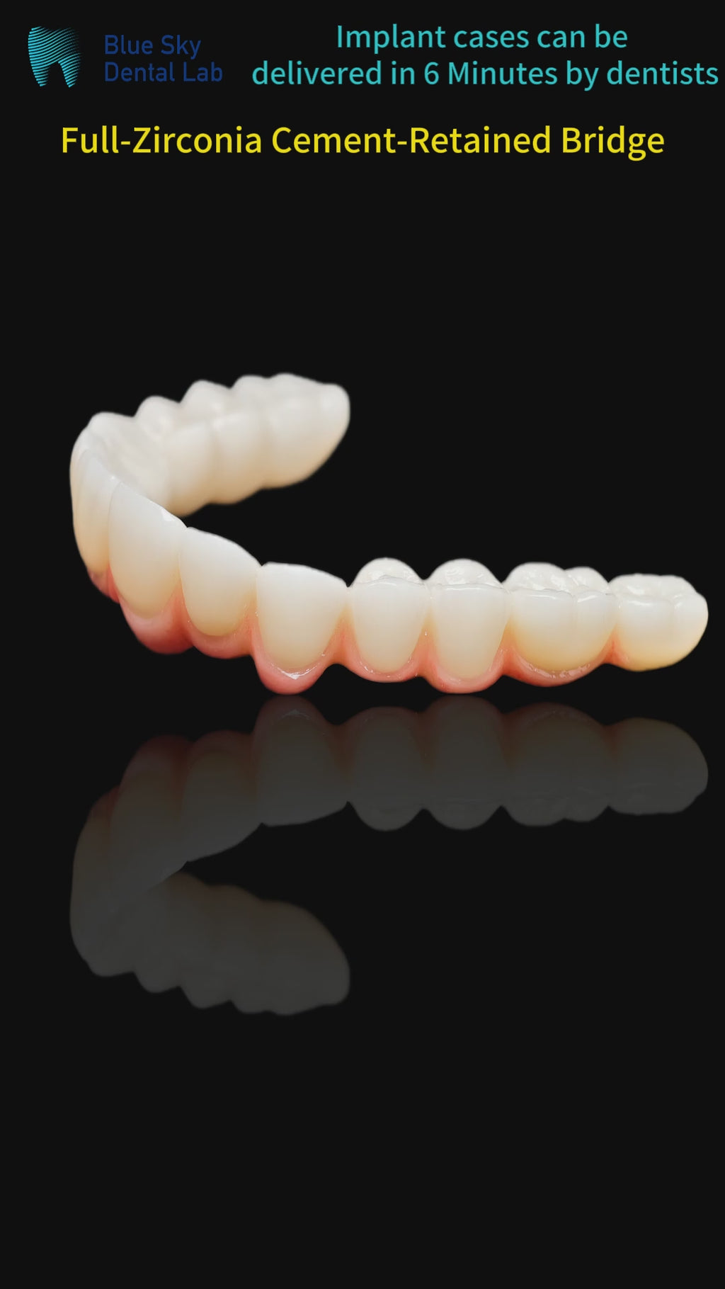 Zirconia Bridge With Cement Retained