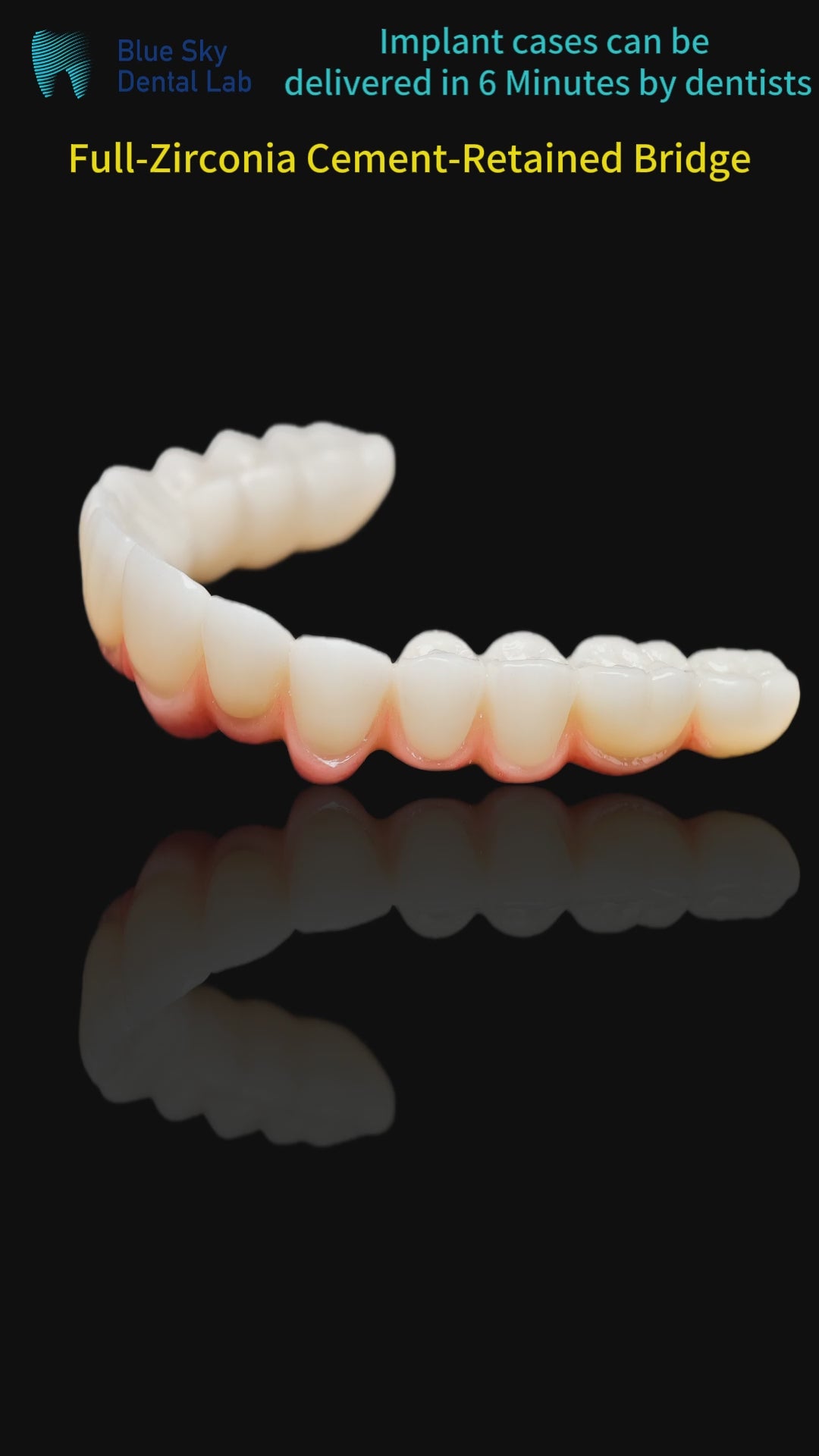 Zirconia Bridge With Cement Retained