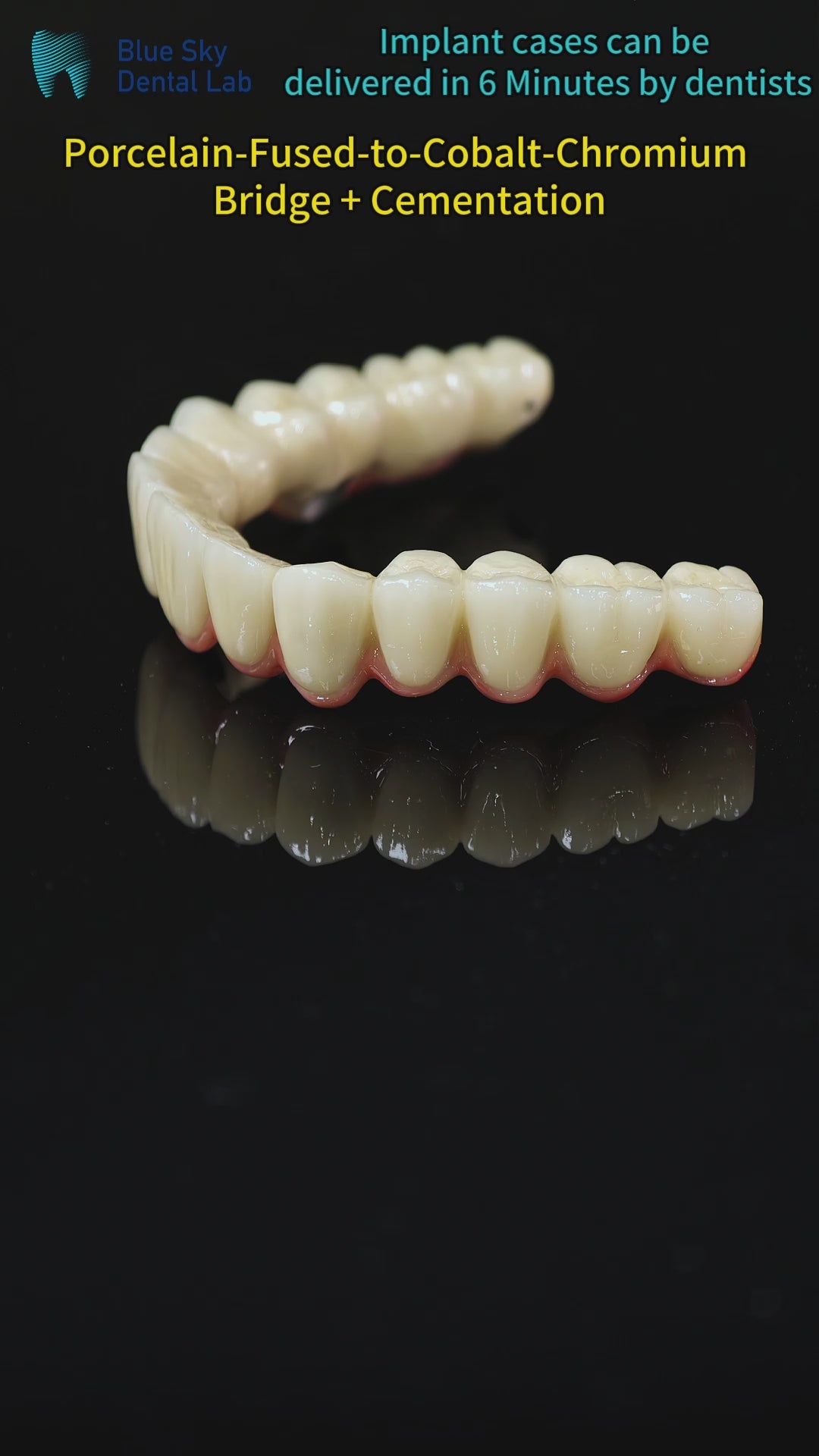 Co - Cr PFM Dental Bridge