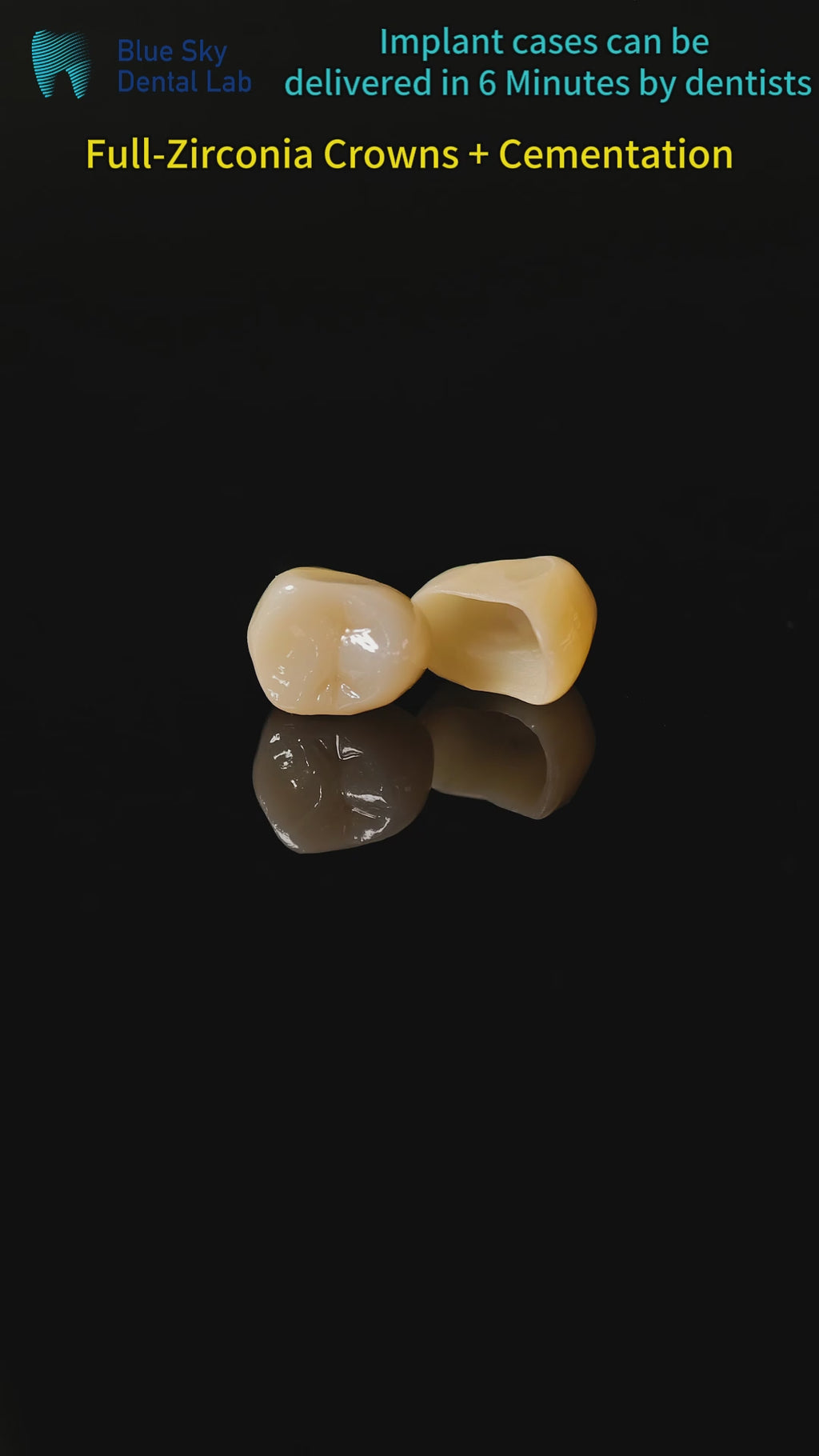 High - Strength Zirconia Crowns