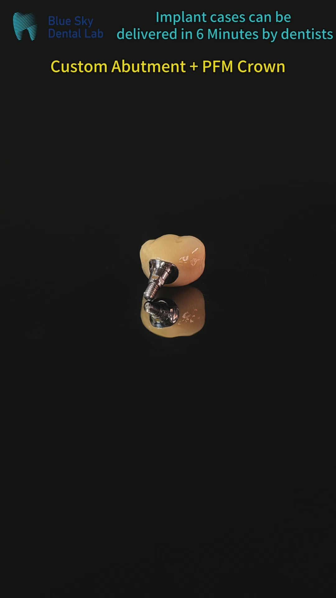 Implant-Supported PFM Single Crown