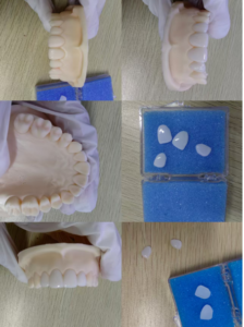 cosmetic dentistry solutions China
